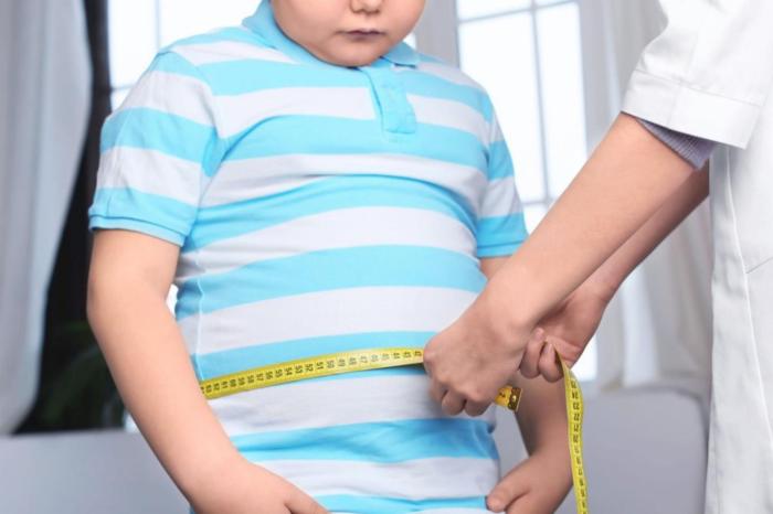 Obesitas anak kompasiana Obesitas anak kompasiana